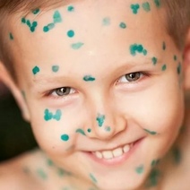 Оренбуржцы стали чаще болеть ветрянкой и педикулезом