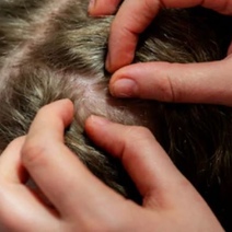 Оренбургских школьников атакует педикулез  