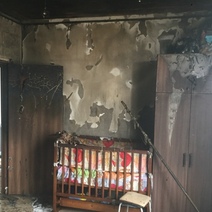 Годовалый оренбуржец, пострадавший из-за взрыва гироскутера, пошел на поправку