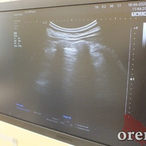 Коронавирус в Оренбуржье на 19 июня