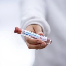 Оренбуржцы жалуются, что результат теста на COVID приходится долго ждать