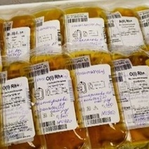 Переболевших оренбуржцев призывают стать донорами антиковидной плазмы