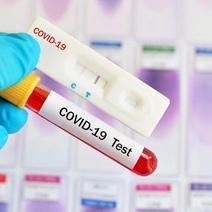 В Оренбуржье установлен новый антирекорд по выявленным случаям коронавируса