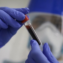 Эксперт рассказал, когда в Оренбургской области начнется спад заболеваемости COVID-19