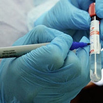 В Оренбургской области от коронавируса скончались еще три человека