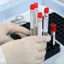 В Оренбуржье проведено более миллиона тестов на COVID-19