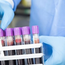 В Оренбургской области от коронавируса скончались еще четыре человека