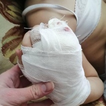 Бастрыкин заинтересовался нападениями бродячих собак на жителей Оренбургской области