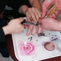 В Оренбурге подросток чуть было не лишился пальца из-за стального кольца