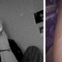 В Бузулуке на 16-летнюю девушку набросились четыре собаки