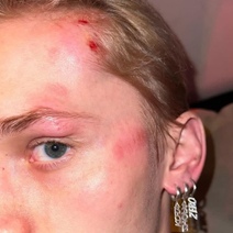 Уроженца Оренбуржья тиктокера Даню Милохина сбил велосипедист