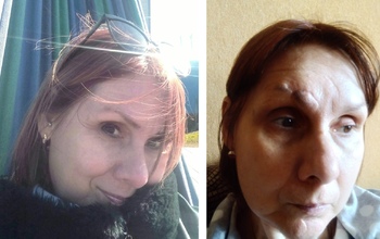 Жительница Бузулука, попав в ДТП, не может добиться справедливости