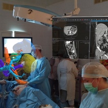 Хирурги из Оренбурга провели сложную операцию в очках виртуальной реальности