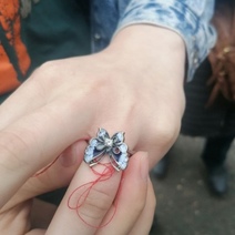 В Оренбурге спасатели распилили кольцо на опухшем пальце девушки