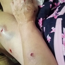 В Оренбургской области полицейский стрелял в агрессивную собаку