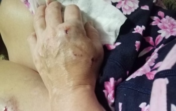 В Оренбургской области полицейский стрелял в агрессивную собаку