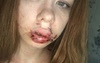 В Орске девушка пожаловалась, что муж выбил ей зубы и рассек губу (18+)