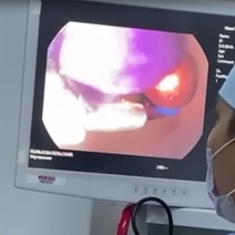 В Оренбуржье трехлетний малыш проглотил 15 магнитиков