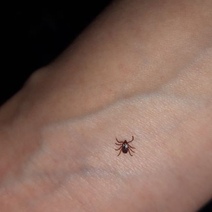 По Оренбуржью продолжают ползать клещи с энцефалитом и боррелиозом