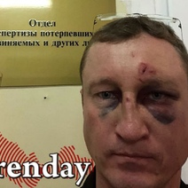 Оренбуржец утверждает, что в аэропорту «Кольцово» его избили полицейские