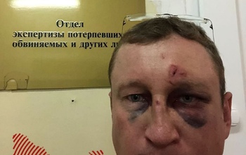 Оренбуржец утверждает, что в аэропорту «Кольцово» его избили полицейские