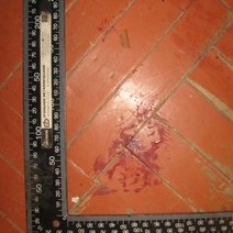 Житель Новотроицка, защищая дерущегося брата, проломил его оппоненту череп (18+)