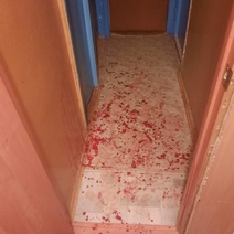 В Ясном женщина забыла, из-за чего исполосовала ножом знакомую (18+)