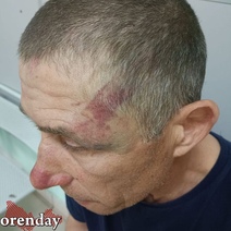 В Оренбурге мужчина избил пенсионера и натравил на него бойцовскую собаку