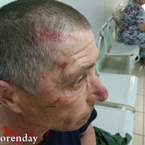 На оренбуржца, избившего пенсионера и натравившего на него бойцовского пса, возбудили уголовное дело