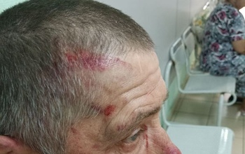 На оренбуржца, избившего пенсионера и натравившего на него бойцовского пса, возбудили уголовное дело