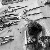 В Оренбурге ребенок наелся монтажной пены