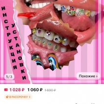 В Оренбуржье подростки уродуют зубы дешёвыми стразами