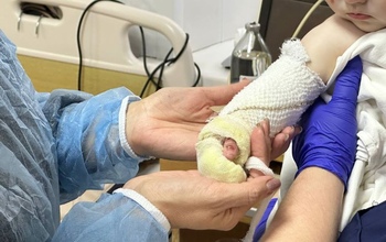 Как себя чувствуют пострадавшие на пожаре под Оренбургом дети