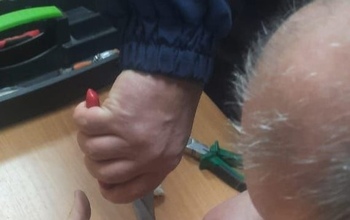В Оренбурге спасатели помогли молодому человеку снять кольцо с опухшего пальца