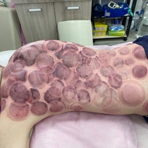 Видеоролики бугурусланского «костоправа» Петра Скрипника, доведшего клиента до реанимации, запретили к распространению 