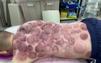 Видеоролики бугурусланского «костоправа» Петра Скрипника, доведшего клиента до реанимации, запретили к распространению 