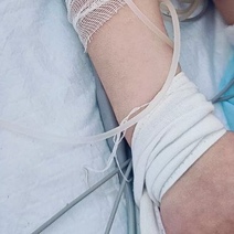 Двухлетний оренбуржец попал в реанимацию после выпитого  ультраконцентрата Азелита 