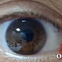 Оренбуржец ослеп 21 год назад и теперь требует 9 миллионов рублей за неудачную операцию