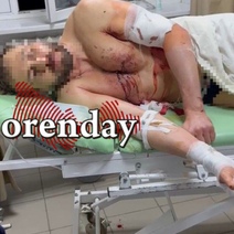 Пострадавшему в ходе перестрелки у Hilton Garden Inn Orenburg провели несколько операций