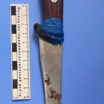 48-летний житель Оренбуржья получил удар ножом от агрессивной собутыльницы (18+)