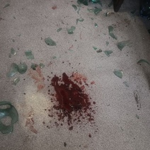 В Саракташе мужчина воспитывал сожительницу банкой по голове