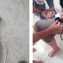 Палец жительницы села Нежинка Оренбургского района попал в блендер