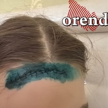 Наложили 15 швов: мать травмированной в детском клубе девочки требует 500 000 рублей