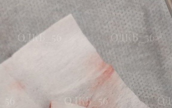 Оренбургские врачи спасли трехлетнего ребенка, проглотившего колпачок от ручки