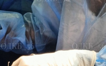 Оренбургские врачи удалили 20-сантиметровую опухоль у 14-летней девочки