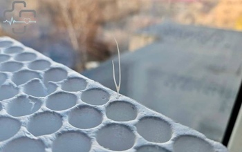 В Орске спасли мужчину с застрявшей в горле костью от рыбы 