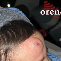 В Оренбурге воспитанники детсада уже больше двух лет ждут ремонта уличных дорожек