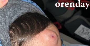 В Оренбурге воспитанники детсада уже больше двух лет ждут ремонта уличных дорожек