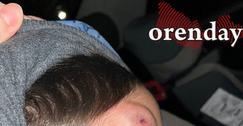 В Оренбурге воспитанники детсада уже больше двух лет ждут ремонта уличных дорожек