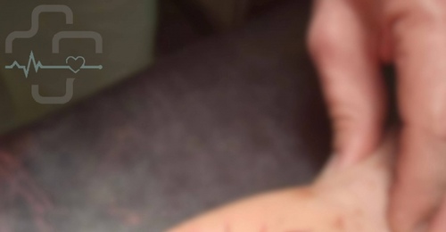 В Орске подросток потерял палец из-за петарды